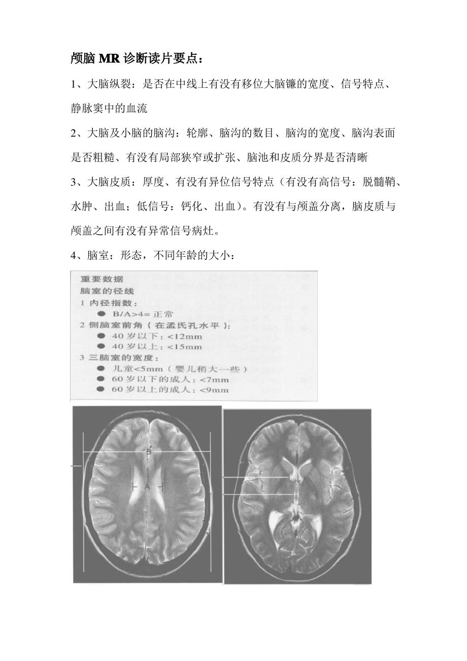 颅脑MRI正常报告_第2页