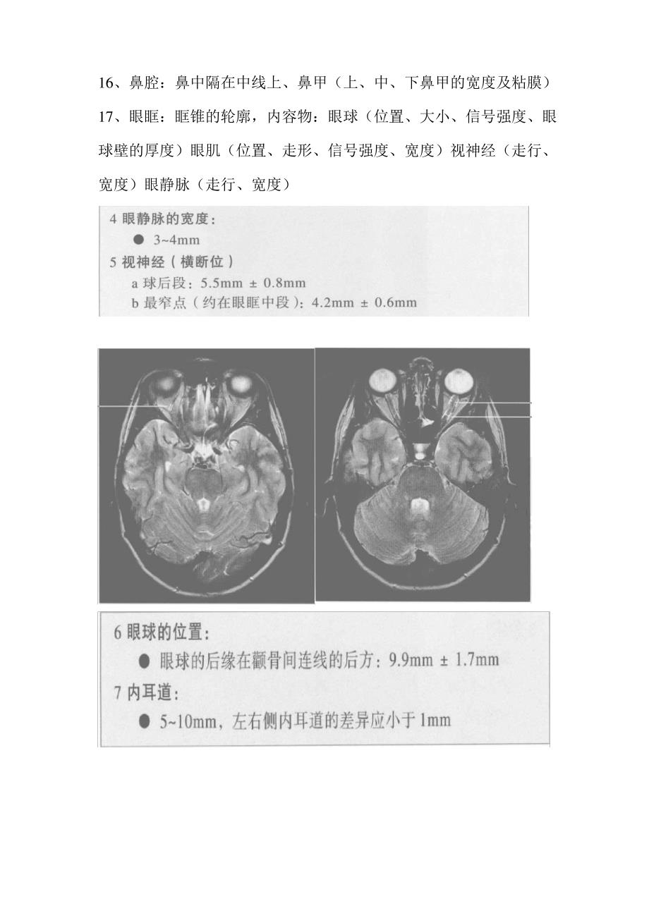 颅脑MRI正常报告_第4页