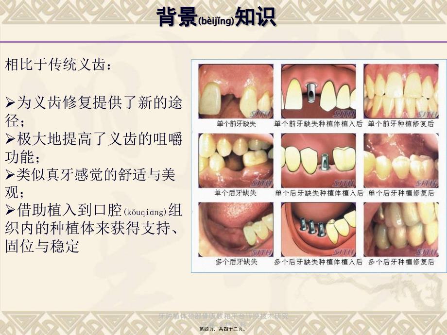 牙种植体颈部骨吸收和平台转换技术研究进展-文档资料课件_第4页