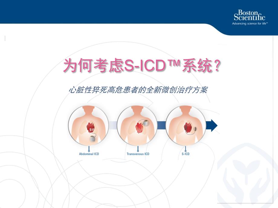 全皮下植入式除颤器SICD的新进展_第3页