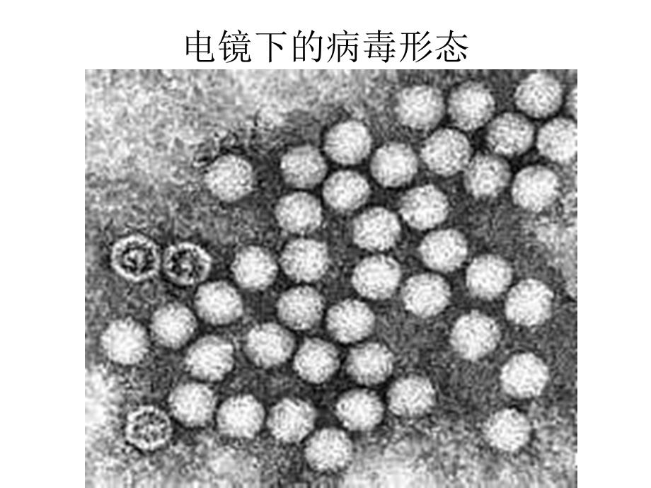 肠道病毒感染病例标本的处理、细胞接种和观察 ppt课件_第3页