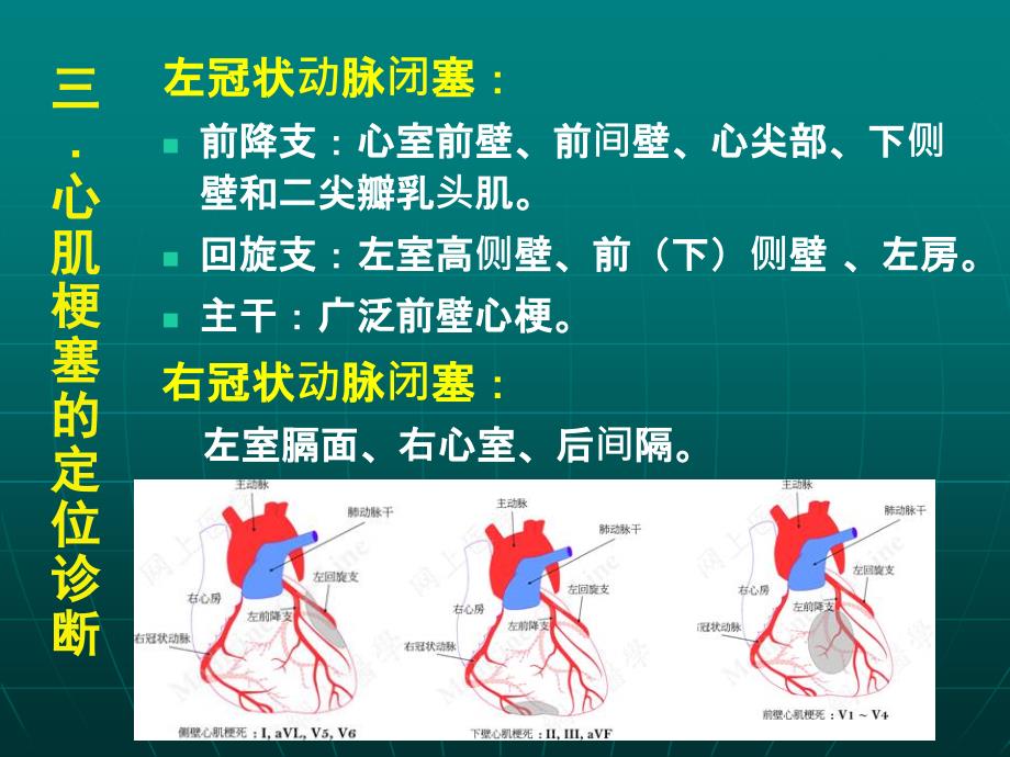 冠状动脉供血区域PPT参考幻灯片_第2页