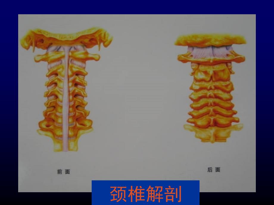 颈椎病--北医大课课件_第4页