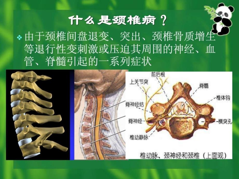 康复医学颈椎病康复宝典ppt课件_第3页