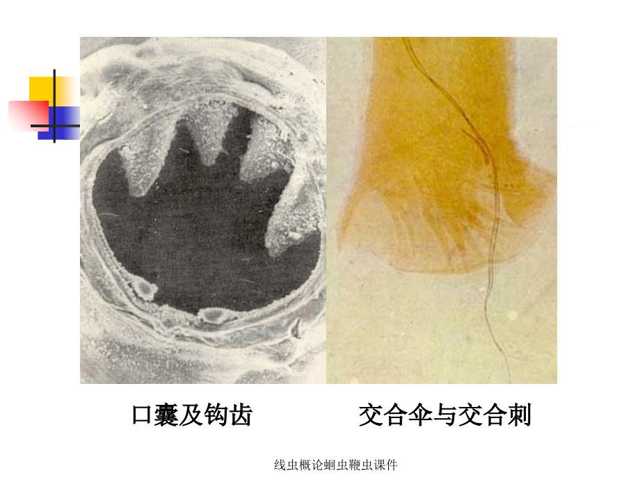 线虫概论蛔虫鞭虫课件_第3页