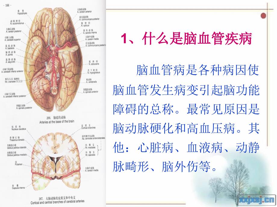 脑血管疾病保健知识ppt课件_第4页