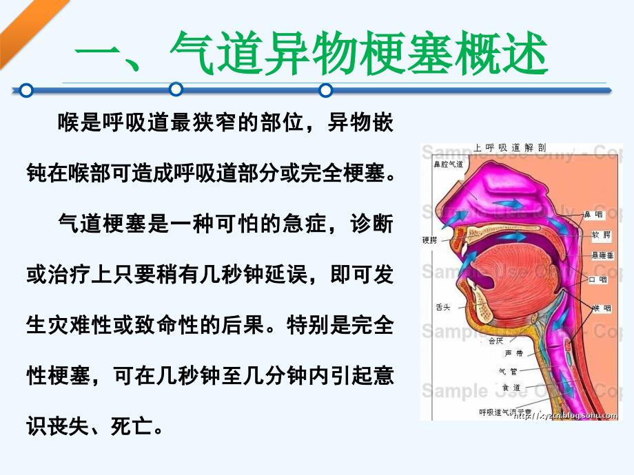 气道异物梗阻的急救培训讲解_第4页