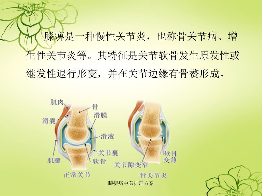 最新膝痹病中医护理方案_第2页