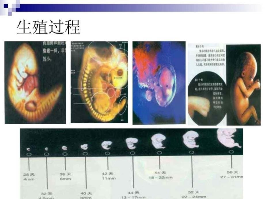 出生缺陷干预 遗传咨询及案例分析_第5页