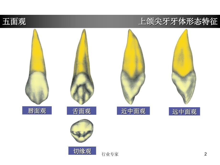 上颌尖牙牙体形态简述行业严选_第2页