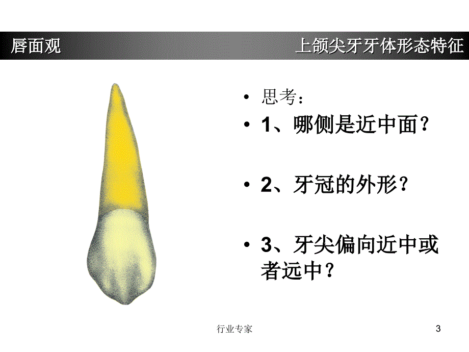 上颌尖牙牙体形态简述行业严选_第3页