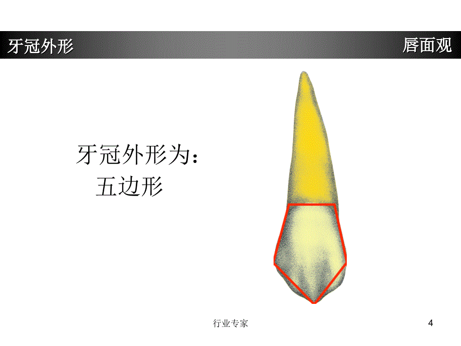 上颌尖牙牙体形态简述行业严选_第4页