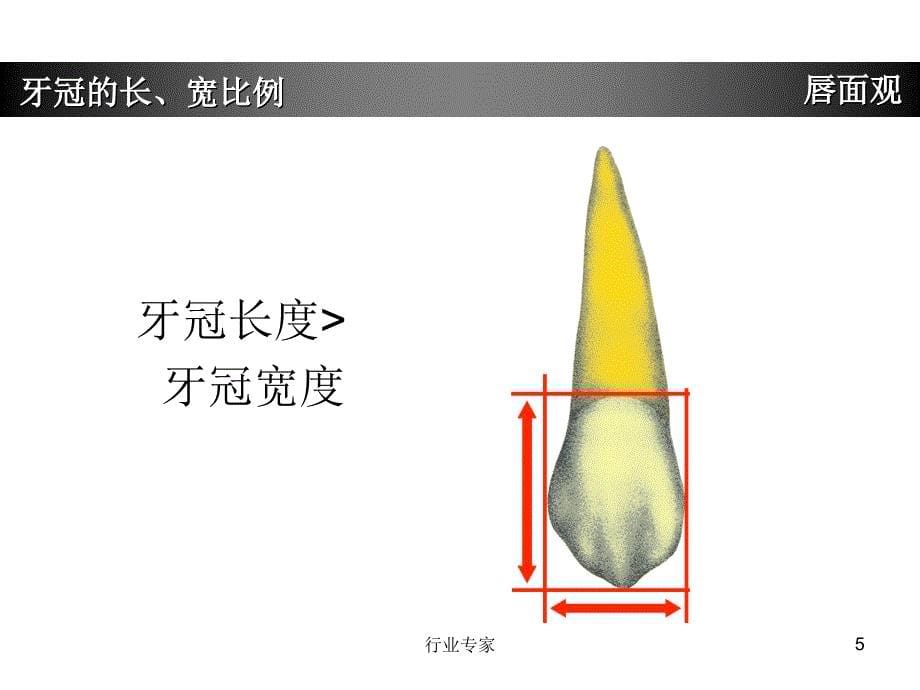 上颌尖牙牙体形态简述行业严选_第5页