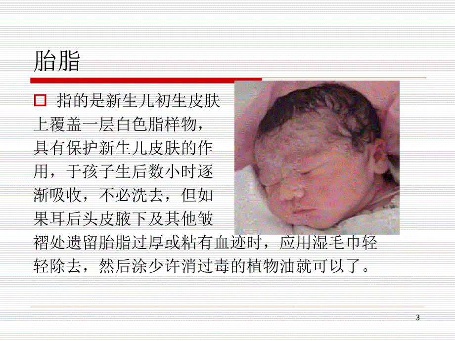 新生儿特殊生理状况PPT课件.ppt_第3页