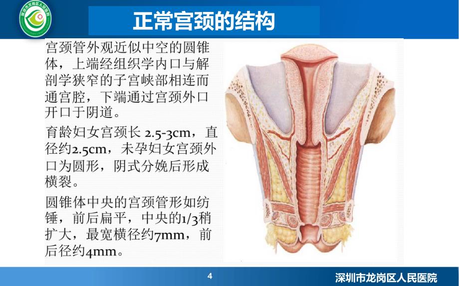 宫颈机能不全_第4页