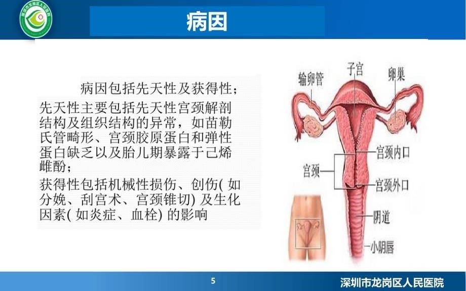 宫颈机能不全_第5页