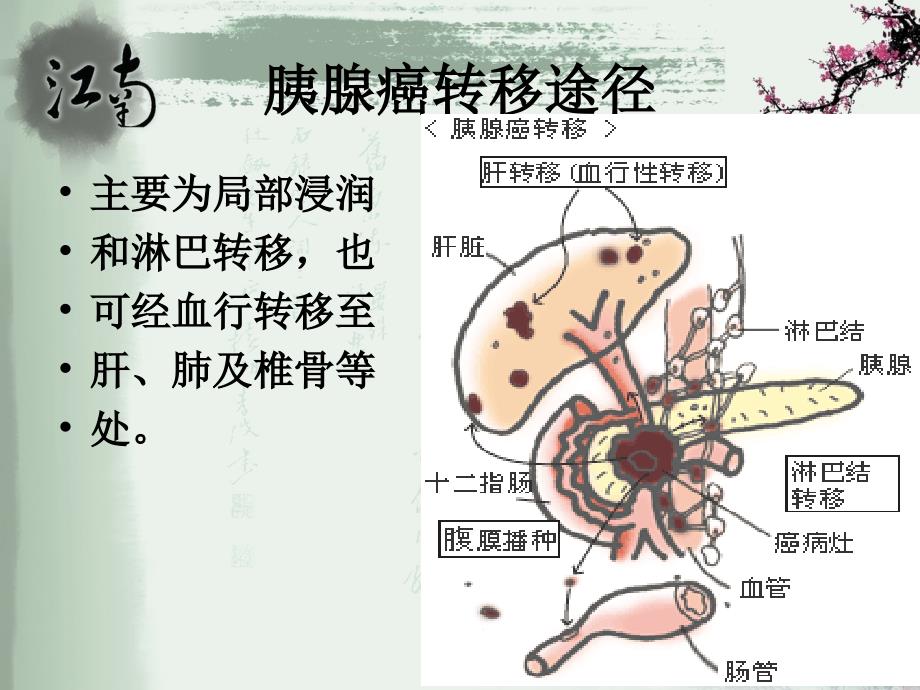 胰腺癌病人的护理_第3页