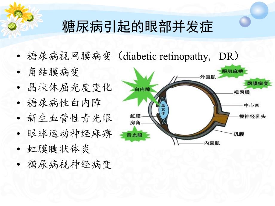 糖尿病眼部病变课件_第4页