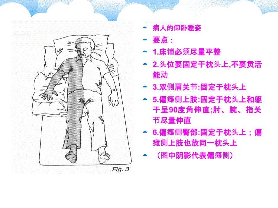 偏瘫患者肢体功能位护理ppt_第2页