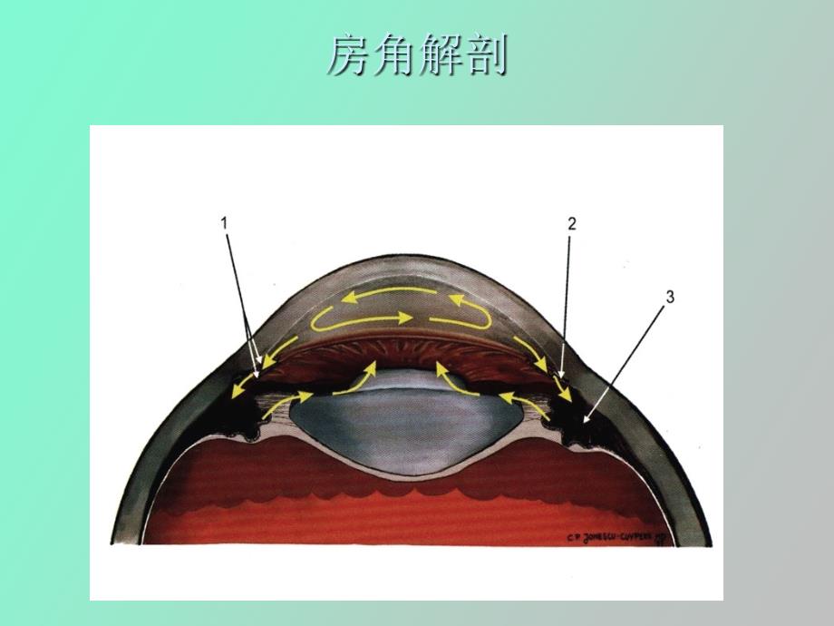 闭角型青光眼_第3页