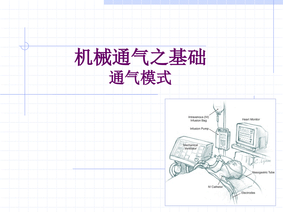 呼吸机模式课件_第1页