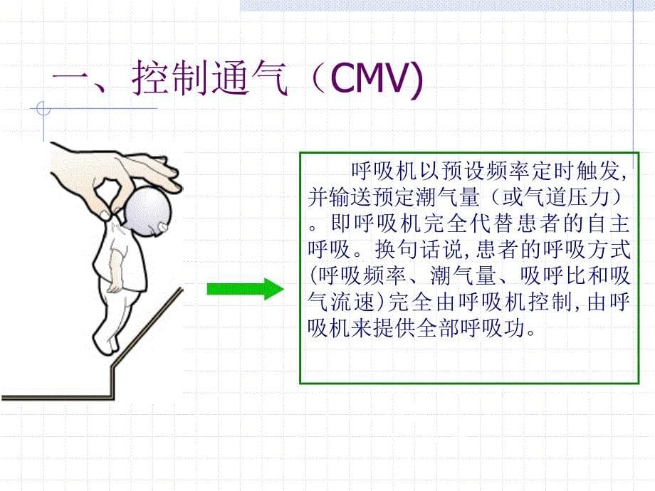 呼吸机模式课件_第5页