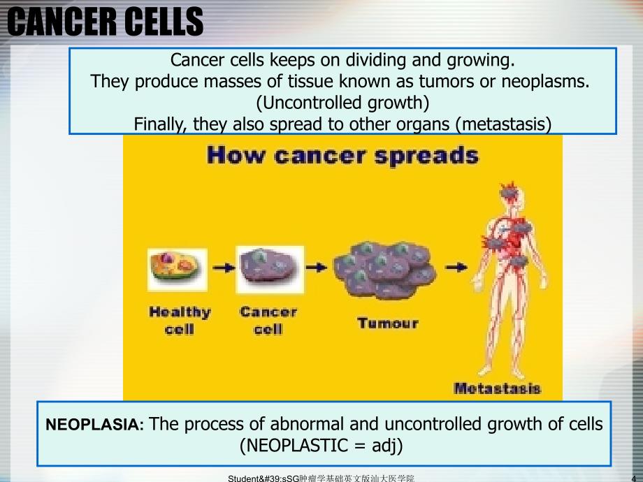 Student&amp;#39;sSG肿瘤学基础英文版汕大医学院免课件_第4页
