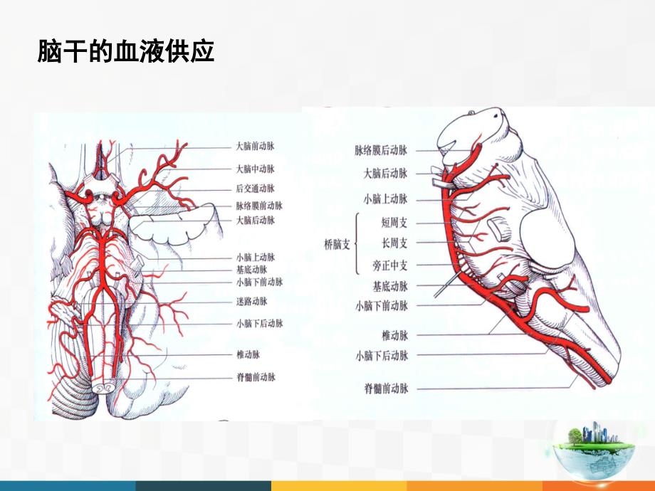 脑干病变综合征课件_第4页