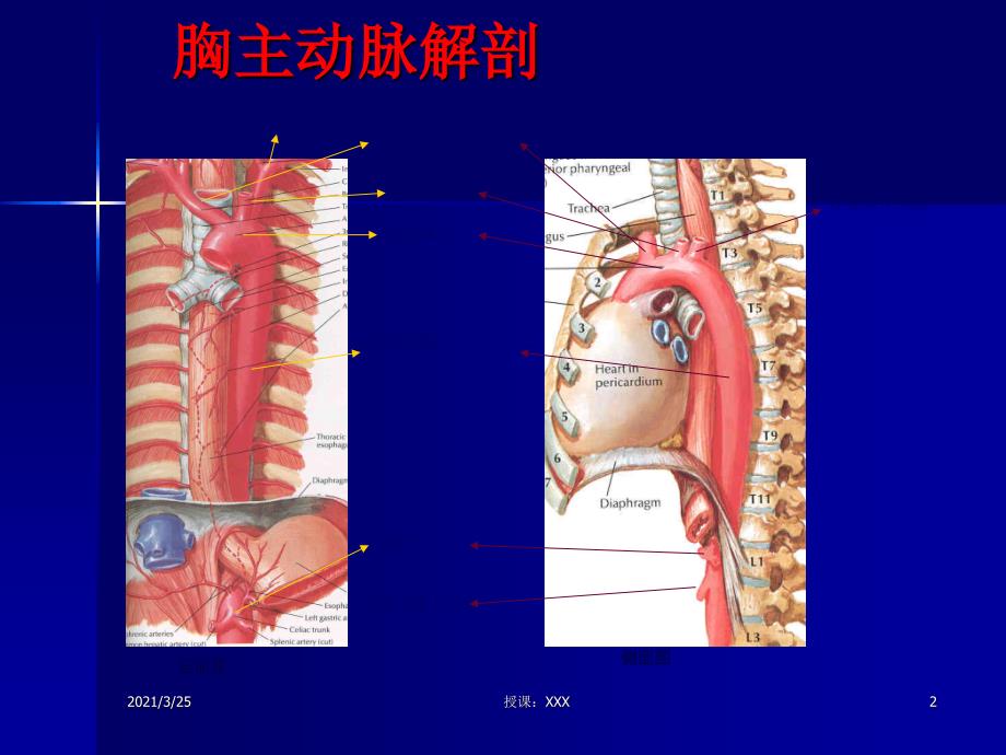 主动脉夹层及腹主动脉瘤CTA影像PPT课件_第2页