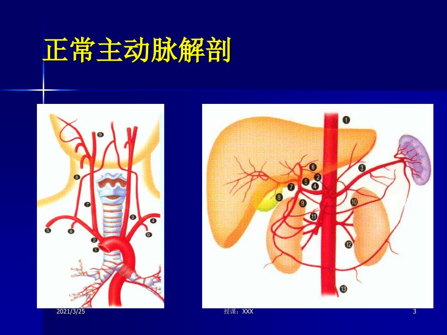 主动脉夹层及腹主动脉瘤CTA影像PPT课件_第3页