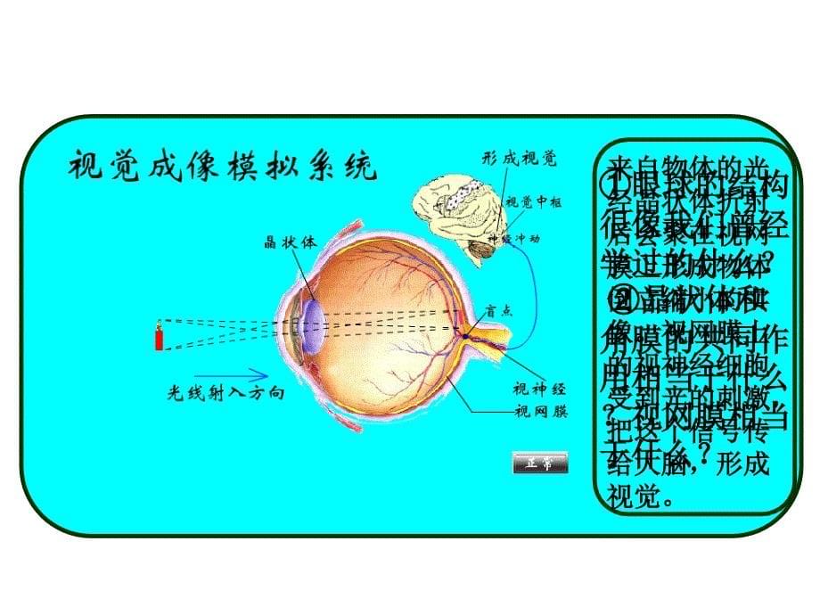 54眼睛和眼镜 (2)_第5页