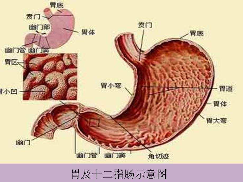 消化性溃疡的护理_第3页