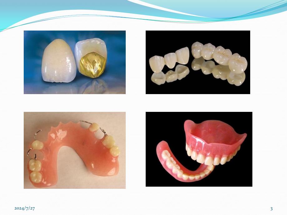 种植义齿概述ppt参考课件_第3页