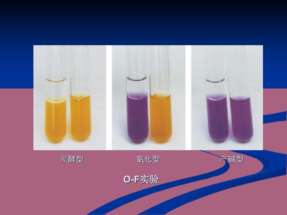 第八章肠杆菌科细菌ppt课件_第4页