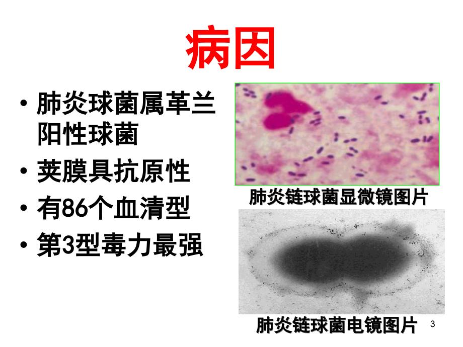 细菌性肺炎课件_第3页