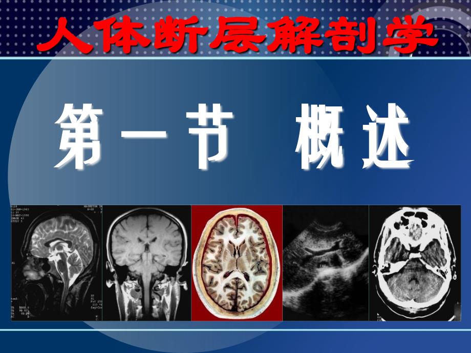 人体断层解剖学胸部断层解剖.ppt_第3页