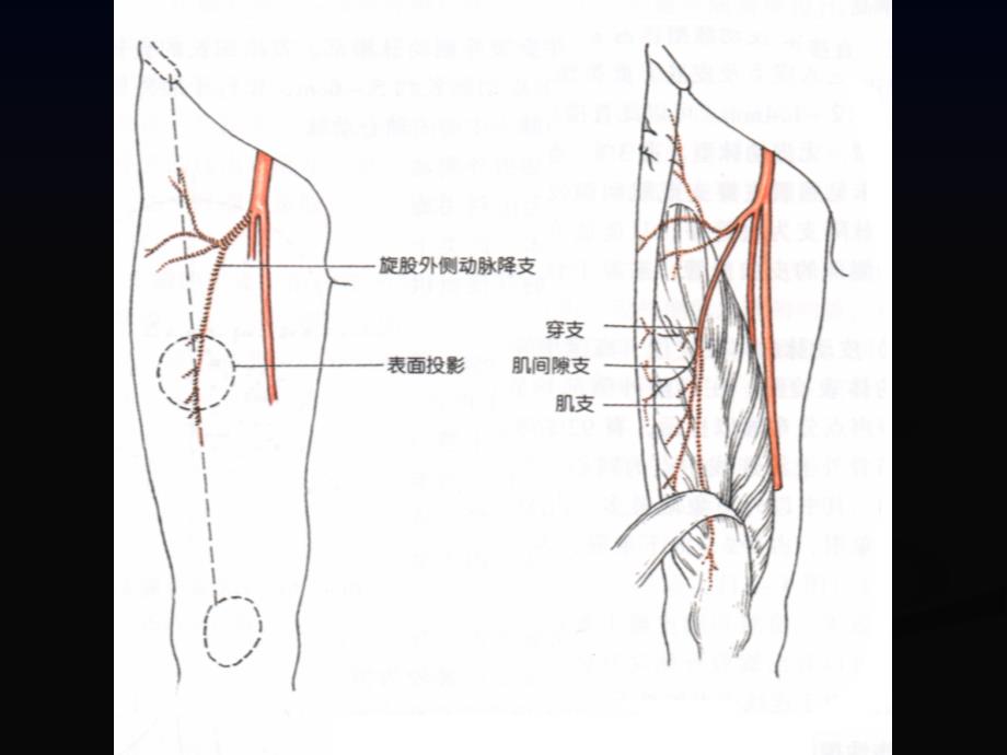 股前外侧皮瓣的解剖与临床应用研究进展课件_第3页