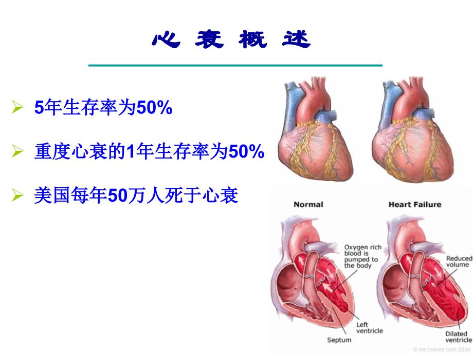 药理学教学课件：治疗充血性心力衰竭药_第4页