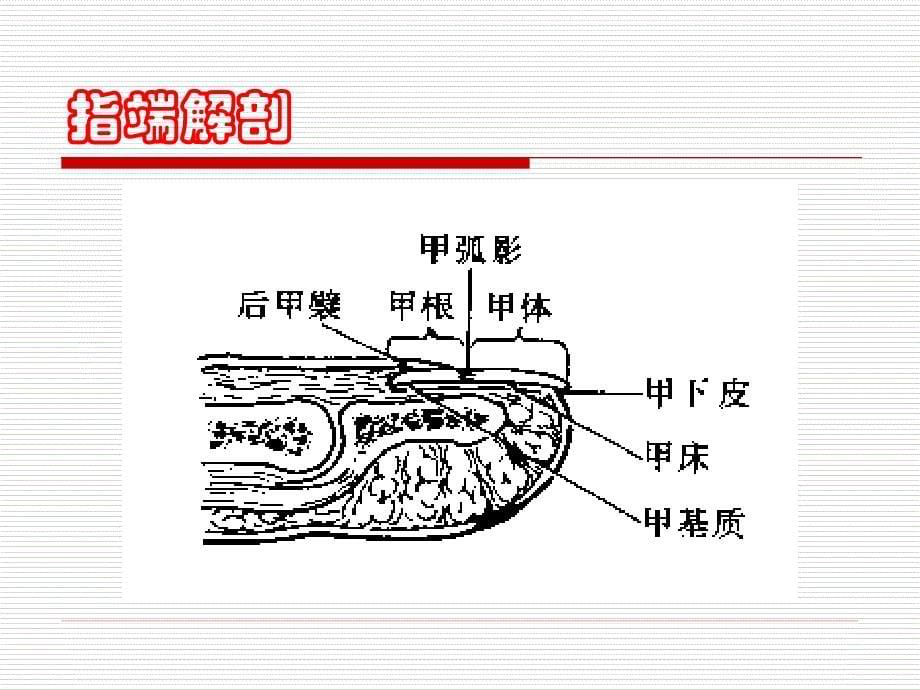 指甲与甲床损伤的处理探讨.ppt_第5页