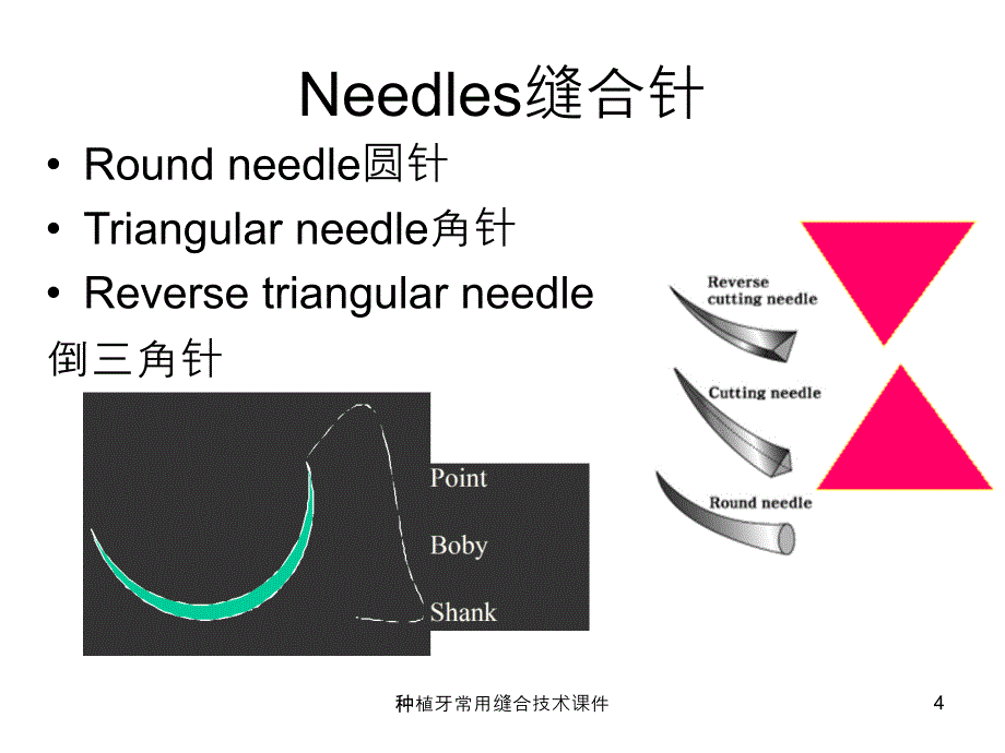 种植牙常用缝合技术课件_第4页