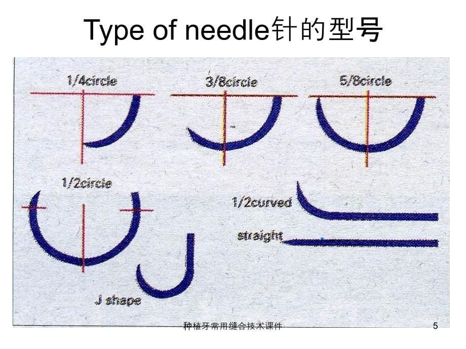 种植牙常用缝合技术课件_第5页