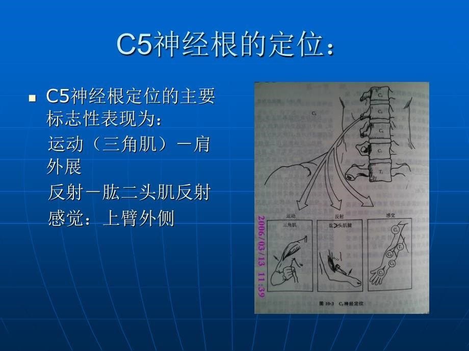 《神经损伤定位诊断》PPT课件_第5页