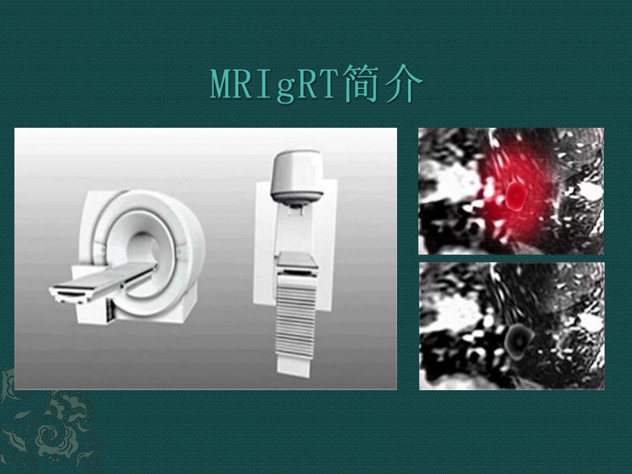 MRIgRT磁共振图像引导放射治疗.pdf_第1页