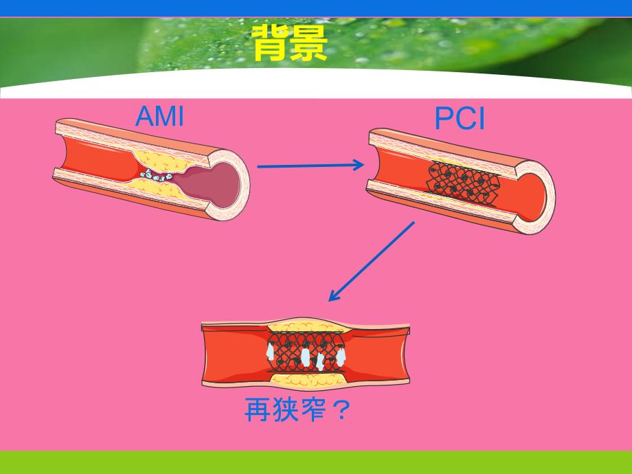 PCI术后抗血小板治疗ppt课件_第3页