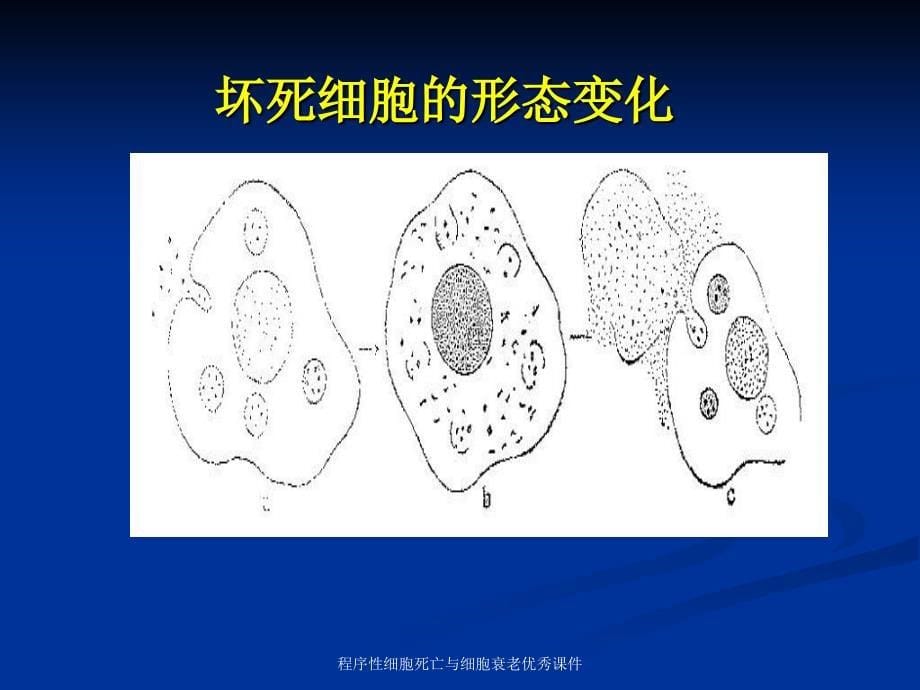 程序性细胞死亡与细胞衰老课件_第5页