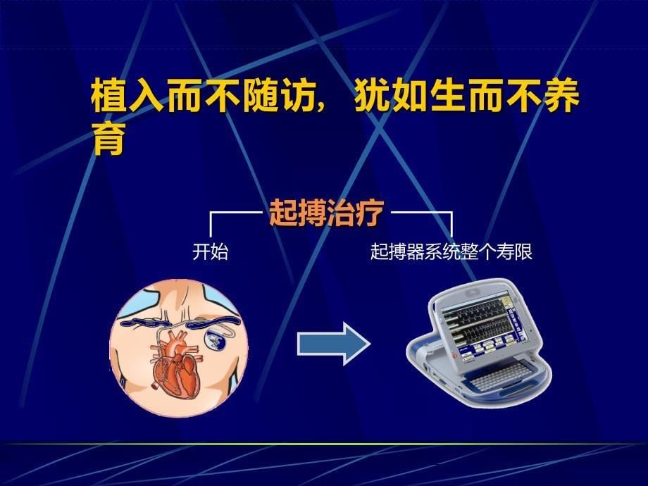 起搏器的程控随访_第5页