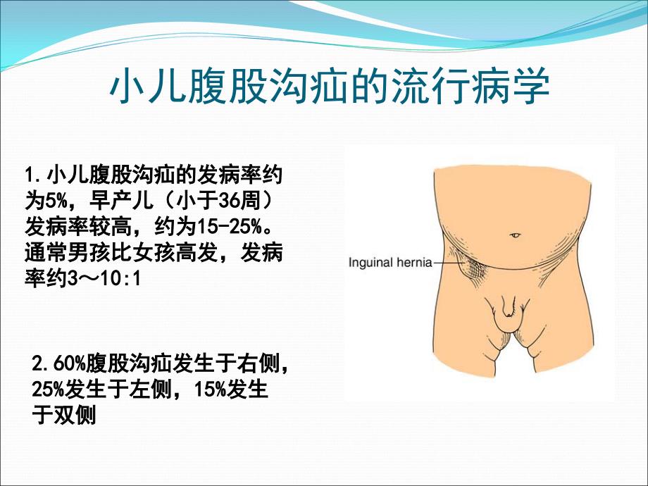 小儿腹股沟疝详解课件_第3页