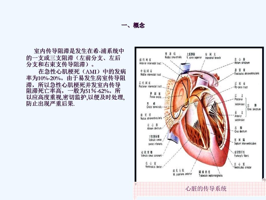 室内传导阻滞在急性心肌梗死中的临床意义及治疗原则ppt课件_第2页