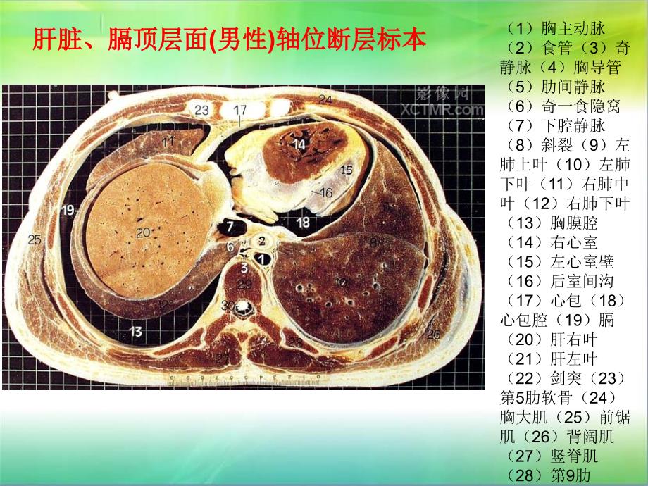 腹部断层解剖和断层CT(精品).ppt_第3页