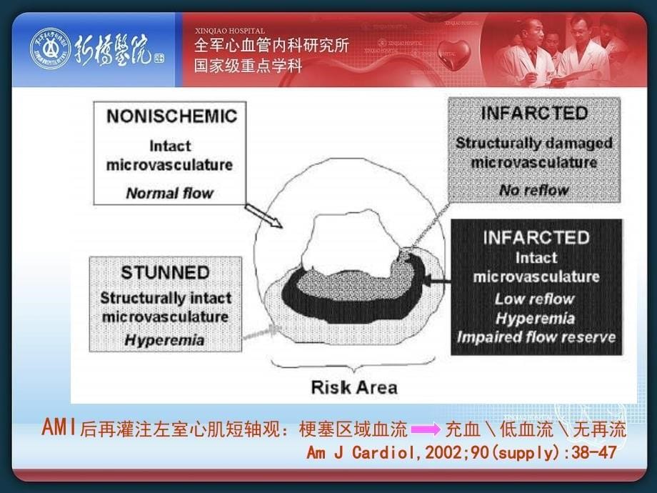 PCI后心肌灌注的评价及意义_第5页